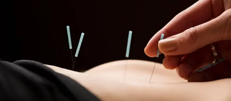 Acupuncture Needling