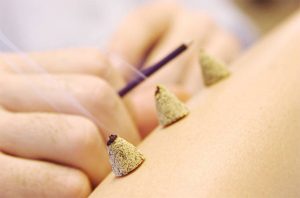 Moxibustion Gold Coast