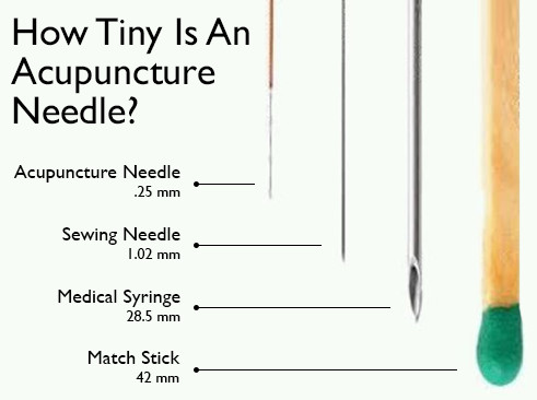 Acupuncture Needle Size